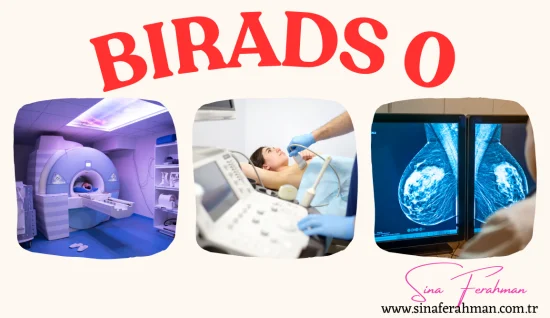 BI-RADS 0 nedir, ne demek, ne anlama gelir? 2025 Kılavuzu