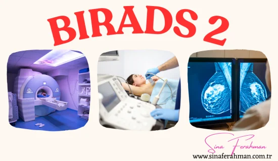 BI-RADS 2 nedir, ne demek, ne anlama gelir? 2025 Kılavuzu ile Değerlendirme
