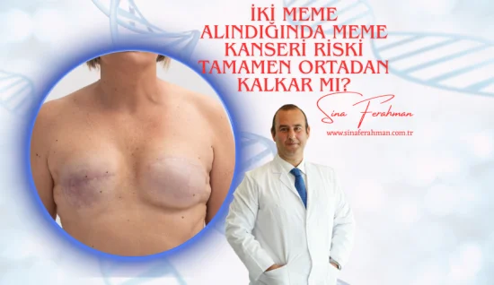 İki Meme Alındığında Meme Kanseri Riski Tamamen Biter mi?