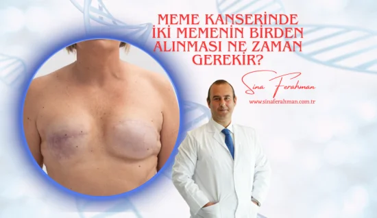 Meme Kanserinde İki Memenin Birden Alınması Ne Zaman Gerekir?