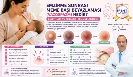 Emzirme Sonrası Meme Başı Beyazlaması (Vazospazm) Nedir? Belirtileri ve Tedavisi | Bilimsel Rehber